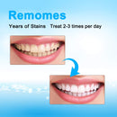 Venus Visage Teeth Whitening Pen(2 Pens), 20+ Uses, Effective＆Painless, No Sensitivity, Travel-Friendly, Easy to Use, Beautiful White Smile, Natural Mint Flavor VENUS VISAGE