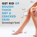 Urea Cream 40% Plus Salicylic Acid 4.6 Oz, Callus Remover Hand Cream Foot Cream For Dry Cracked Feet, Hands, Heels, Elbows, Nails, Knees, Intensive Moisturizes & Softens Skin, Exfoliates Dead Skin Ebanel