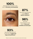 StriVectin Tighten & Lift Peptight 360 Degree Eye Serum with Tightening & Brightening Peptides for Wrinkles, Under Eye Bags and Puffiness, 1 fl. Oz StriVectin