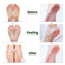 Tea Tree Foot Peel Mask For Dead Skin, Callused and Cracked Heels, Foot Mask Removes Rough Heels Dry Dead Skin,Makes Foot Soft Smooth Skin, Exfoliating Peeling Natural Treatment- 2 PACK LYNNC