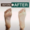 Tea Tree Oil Body Wash - Antifungal - Antibacterial Soap-Helps Athletes Foot - Toenail Fungus - Ringworm - Jock Itchy - Acne - Eczema - Yeast Infection - Body Odor - Itchy Skin - Sulfate Free - 16oz ORISO