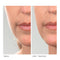 Michael Todd Beauty - Sonicsmooth Replacement Kit for At-Home Dermaplaning - 7 Replacement Safety Edges Only MICHAEL TODD BEAUTY
