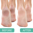Maccibelle Salon Foot Pumice and Scrubber for Feet and Heels Callus and Dead Skins, Safely and Easily Eliminate Callus and Rough Heels (Pack of 4) Maccibelle