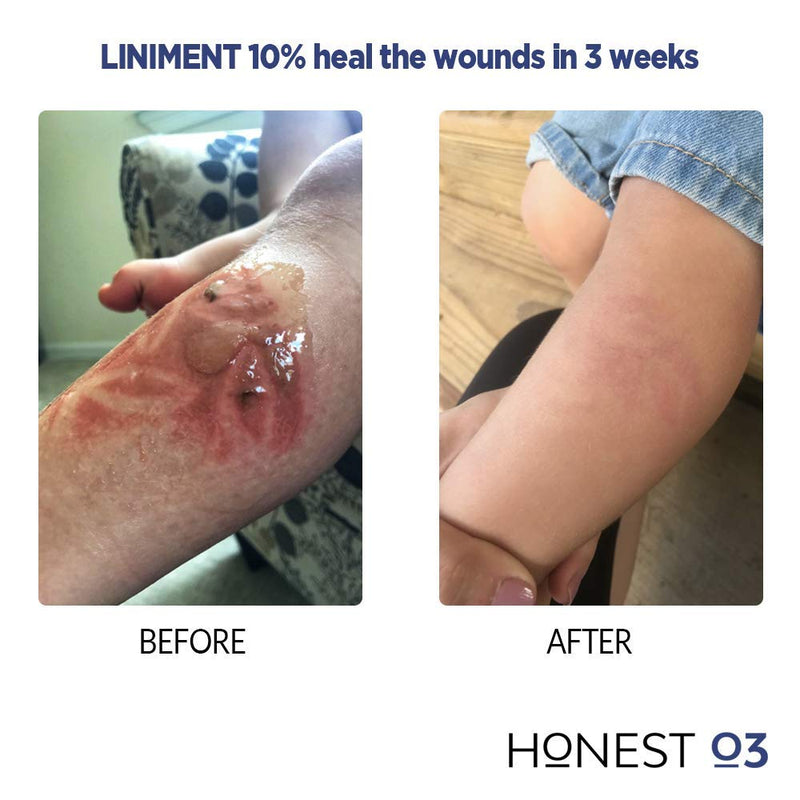Honest O3 Liniment 10% Ozone Oil | Natural Ozone Infused Skincare Cream | Promotes Healthy Skin | Moisturizes & Nourishes | Fast Absorbing Ozone Cream 1.2 Ounces Honest O3