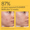 Nutrafol Clear Skin Acne Supplement for Women, Clinically Tested for Clearer, Smoother Skin, Physician-Formulated, Vegan Infinity Warehouse