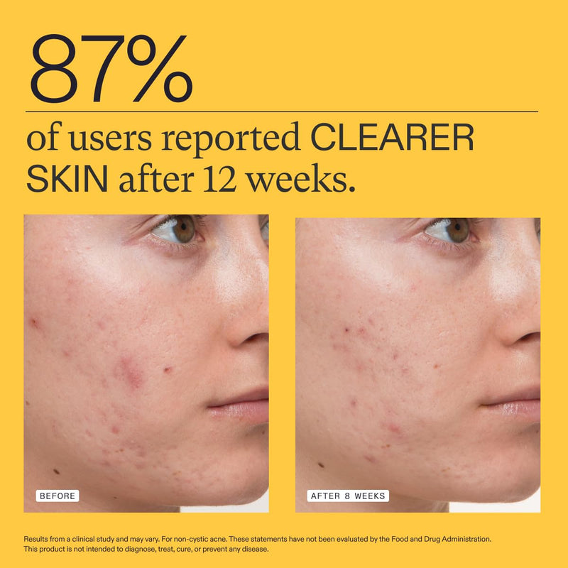 Nutrafol Clear Skin Acne Supplement for Women, Clinically Tested for Clearer, Smoother Skin, Physician-Formulated, Vegan Infinity Warehouse