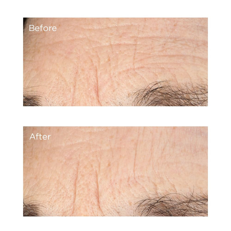 Perricone MD Essential Fx Acyl-Glutathione Deep Crease Serum 1.01 fl oz (Pack of 1) Infinity Warehouse