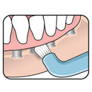 TEPE Compact Tuft Toothbrush, Ultra Soft Toothbrush, Denture Brush, Orthodontic Toothbrush for Braces, 1 Pk TEPE PRODOTTI IG.ORALE Srl