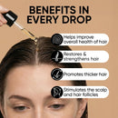 MOERIE Ultimate Hair Growth Serum for Natural Hair Regrowth & Thickening - Anti Thinning & Hair Loss Treatment for Women - Rapid Hair Growth Products - Scalp Oil Alternative - 1.69 fl oz / 50 ml Infinity Warehouse