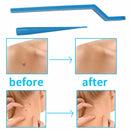 Skin Tag Remover, Safe and Painless Skin Tag Removal Kit for Face, Neck, Finger and Body, Smooth Results Small to Medium (0.08 to 0.2 in) Sized Skin Tags HomeSimlife