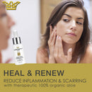 LEROSETT Healing Serum for Acne Scarring, Redness, Breakouts, Irritation, Hydrate, Soothe, Firm, Plump, with Organic Aloe Vera, Collagen, Elastin, Keratin, Vitamin C, Ginseng 1 oz Gunilla Of Sweden