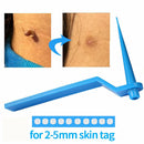 Skin Tag Remover, Safe and Painless Skin Tag Removal Kit for Face, Neck, Finger and Body, Smooth Results Small to Medium (0.08 to 0.2 in) Sized Skin Tags HomeSimlife