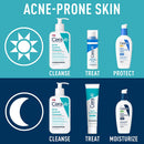 CeraVe Face Wash Acne Treatment | Salicylic Acid Cleanser with Purifying Clay for Oily Skin | Blackhead Remover and Clogged Pore Control | 8 Ounce CeraVe