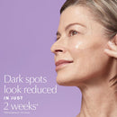 Estée Lauder Perfectionist Pro Rapid Brightening Treatment Face Serum with Ferment3 + Vitamin C | Targets Dark Spots Infinity Warehouse