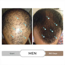 DS Labs Spectral Men's & Spectral Booster, Hair Density Serum - Leave-In, Strengthening, Thickening, Minimize Shedding, 60mL, Packaging May Vary Infinity Warehouse