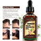 Hair Growth Serum, VOTALA Hair Growth Treatment, Anti Hair Loss, Promotes Thicker, Stronger Hair, And Hair Regrowth for Men Women Votala
