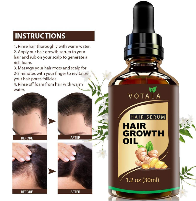 Hair Growth Serum, VOTALA Hair Growth Treatment, Anti Hair Loss, Promotes Thicker, Stronger Hair, And Hair Regrowth for Men Women Votala