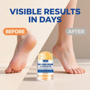 Urea Cream Stick 60% plus 2% Salicylic Acid, 2PCS Maximum Strength Urea Cream for Feet, Foot Lotion Stick for Cracked Heels, Dry Hands & Rough Knees, Callus Remover & Skin Softener, Soften Dead Skin Infinity Warehouse