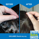 Dermasolve Eczema Relief Shampoo - Flare Control Scalp & Dandruff Free Therapy That Protects, Moisturizes, and Repairs Skin for Kids & Adults - Steroid Free (2-Pack) Infinity Warehouse