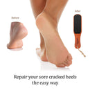 Pumice Stone Foot File - Wooden Pedicure Feet Scrubber with Handle for Callus, Dry, and Dead Skin Removal - Heel Scraper for Feet, Hands, and Body Exfoliation - Perfect Foot Filer for Use in Shower Pumice Valley