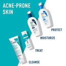 CeraVe Acne Foaming Cream Cleanser | Acne Treatment Face Wash with 4% Benzoyl Peroxide, Hyaluronic Acid, and Niacinamide | Cream to Foam Formula | 5 Oz CeraVe