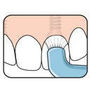 TEPE Compact Tuft Toothbrush, Ultra Soft Toothbrush, Denture Brush, Orthodontic Toothbrush for Braces, 1 Pk TEPE PRODOTTI IG.ORALE Srl