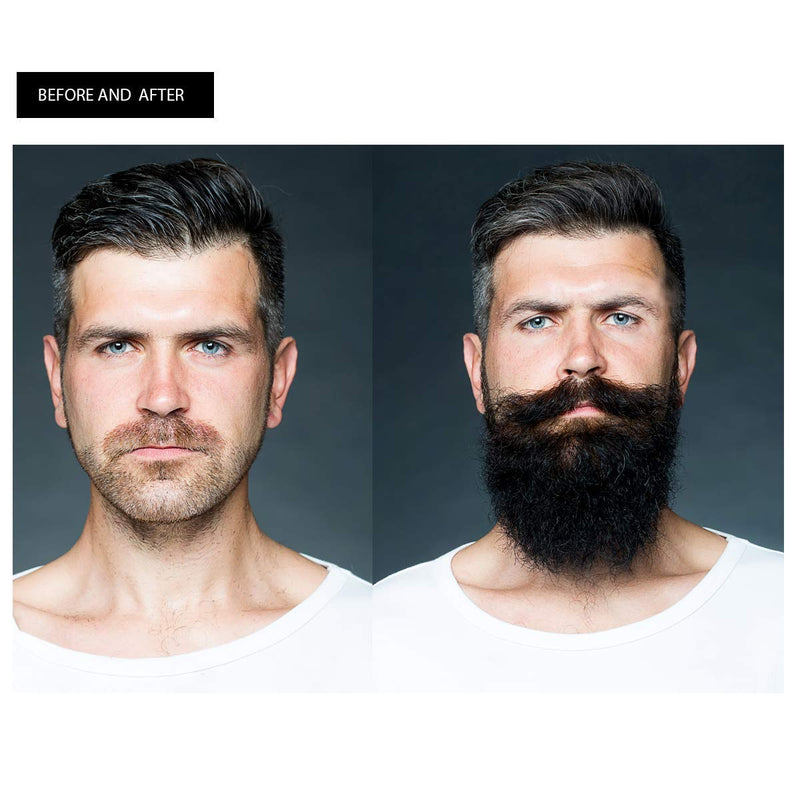 Beard Growth Kit, Natural Hair Growth Serum for Men with Patchy Facial Growth, Stimulate, Promote Hair Regrowth (2in1) YOUCOPIA