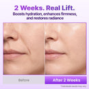 BIOHEAL BOH Probioderm 3D Lifting Cream Mist 3.38 fl oz | Korean Face Mist with Cream-Like Hydration for Instant Glow, Firm-Looking Skin & On-the-Go Refresh Infinity Warehouse