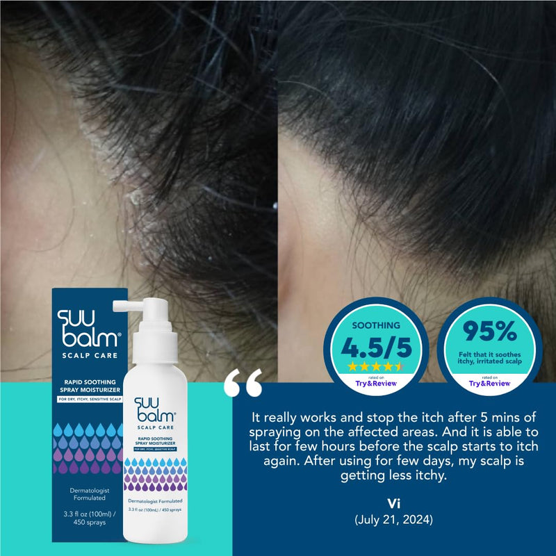 Rapid Itch Relief Anti-Dandruff Scalp Spray Moisturizer, Cooling Itchy Scalp Treatment for Dry Flaky Sensitive & Psoriasis Scalp, Derm-Formulated with Menthol & 5 Ceramides,1.35 fl oz Infinity Warehouse