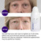 Beverly Hills V-Lift Instant Eye Lift and Eye Tuck Bee Venom Serum for Treating Puffy Eyes, Dark Circles, and Wrinkles BEVERLY HILLS