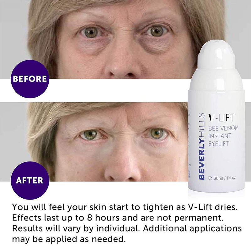 Beverly Hills V-Lift Instant Eye Lift and Eye Tuck Bee Venom Serum for Treating Puffy Eyes, Dark Circles, and Wrinkles BEVERLY HILLS