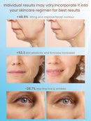 Radio Frequency Skin Tightening Device, Smart Electric Zinc Alloy Facial Beauty Machine with RF-Current Cold Heat for Jawline Lifting, Cheek Firm, Wrinkle Reduction, Depuff, Increase Absorption Infinity Warehouse