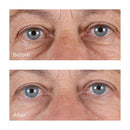 Perricone MD High Potency Hyaluronic Intensive Hydrating Serum, 2 fl. oz. Infinity Warehouse