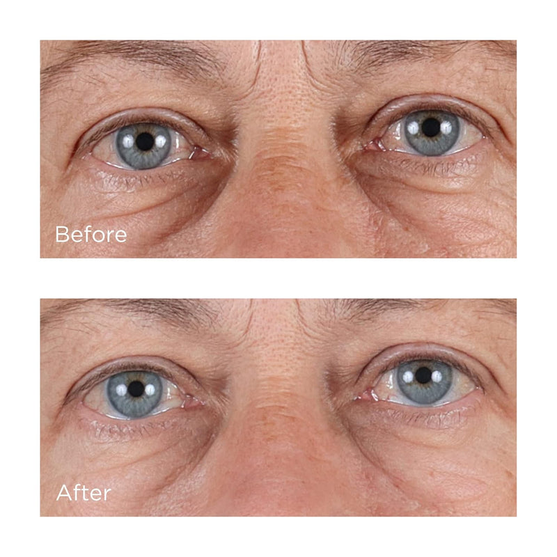 Perricone MD High Potency Hyaluronic Intensive Hydrating Serum, 2 fl. oz. Infinity Warehouse