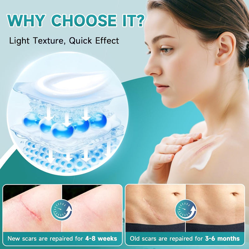 Advanced Scar Cream, Silicone Gel for Scars, Professional Scar Removal Cream for Surgical Scars, Stretch Marks, Old and New Scars 1.7 oz(50ml) Infinity Warehouse