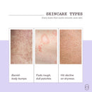frank body Niacinamide Body Scrub | Fights Breakouts & Dryness | Exfoliating Body Scrub | Berry Extracts & Green Tea | Berry Scent | Vegan & Cruelty Free | 250g / 8.82 oz Infinity Warehouse