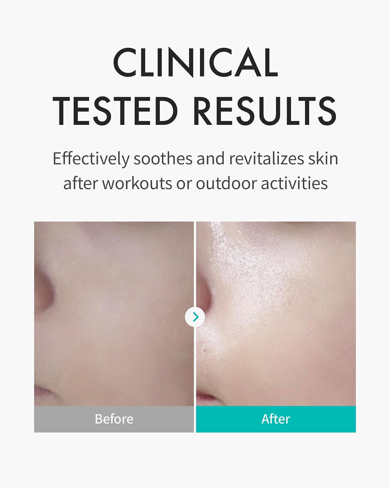 REJURAN® Skin Protection Mask, c-PDRN® – Hydrating and Soothing Facial Sheet Mask for Irritated, Stressed, Repairs & Restores Skin Barrier with Panthenol & Allantoin, Korean Skin Care. 5-Pack Infinity Warehouse