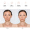 NewWay High Frequency Facial Therapy Wand Machine with 4 Argon Tube for Skin Tightening, Acne Treatment, Wrinkle Reducing Hair Follicle Professional Facial Beauty NewWay