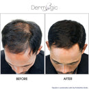 Hair Growth Serum-Extra Strength DHT Blocker - Stimulates & Repairs New Follicle Regrowth. Grow Stronger, Thicker, Fuller, Longer, Healthier Hair. For Men & Women with No Side Effects. Dermlogic