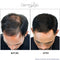 Hair Growth Serum-Extra Strength DHT Blocker - Stimulates & Repairs New Follicle Regrowth. Grow Stronger, Thicker, Fuller, Longer, Healthier Hair. For Men & Women with No Side Effects. Dermlogic