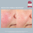 RescueMD DNA Repair Complex Scar Treatment Serum, Redness and Skin Damage Solution, 30mL Infinity Warehouse