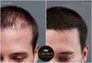 CROWN HAIR FIBERS for Thinning Hair (MEDIUM BLONDE) - Instantly Thickens Thinning or Balding Hair for Men & Women - 0.87oz/25g Bottle - Best Natural Keratin Hair Loss Concealer CROWN HAIR FIBERS