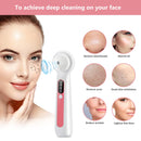 Blackhead Remover Vacuum, Upgraded Visible Facial Pore Cleaner with Magnifier & LED Filling Light, 3 Removable Suction Nozzles & 4 Acne Comedone Pimple Extractor Tools & USB Charging Cable Included Yootte