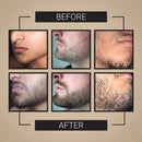 Crafted Beard Growth Oil, Beard Growth Serum, Beard Serum, Grow A Thicker Beard Quickly, Beard Oil Growth, Beard Growth, Grow Beard, Beard Grow, 1oz - Unscented (1 Pack), Amber Crafted