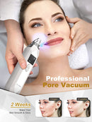Blackhead Remover Pore Vacuum EUHOME Electric Rechargeable Blackhead Whitehead Acne Comedone Pimple Extractor Facial Pore Cleaner Blackhead Removal Kit 5 Suction Probes Face Cleaning Tools EUHOME