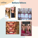 Lumineux Oral Essentials Teeth Whitening Strips - 21 Treatments - Dentist Formulated and Certified Non Toxic - Sensitivity Free - Whiter Teeth in 7 Days - NO Artificial Flavors, Colors, and SLS Free Oral Essentials