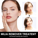 Milia Remover Treatment Serum, Spot Treatment for Clear Skin, Acne Serum for Eye & Face, Easy to carry (1 count pack of 30ml) (black) Infinity Warehouse