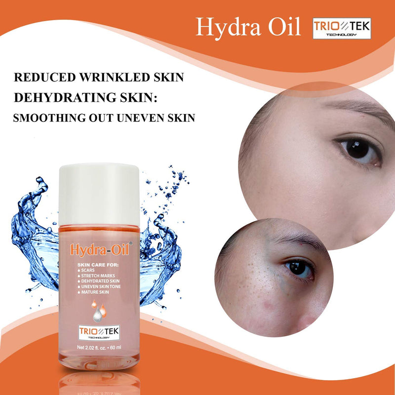 Hydra-Oil Scar Removal Serum - Scar Treatment for Face and Body - 50 ml Hydrating Oil for Acne Scar Remover, Stretch Mark Removal, and to Lighten Dark Spots - Vitamin E & A Hydra Oil