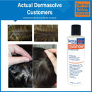 Scalp Psoriasis & Dandruff Shampoo and Conditioner by DermaSolve | Seborrheic Dermatitis Shampoo & Conditioner - Naturally Heals Itchy Flakey Inflamed Skin and Provides Soothing Moisturizing Relief Dermasolve