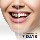 Smilestra Teeth Whitening Kit with LED Light, Non-Sensitive Teeth Whitener with 3 Tooth Whitening Gel Pens, 35% Carbamide Peroxide, Teeth Whitening Products Made in USA with Case. Smilestra